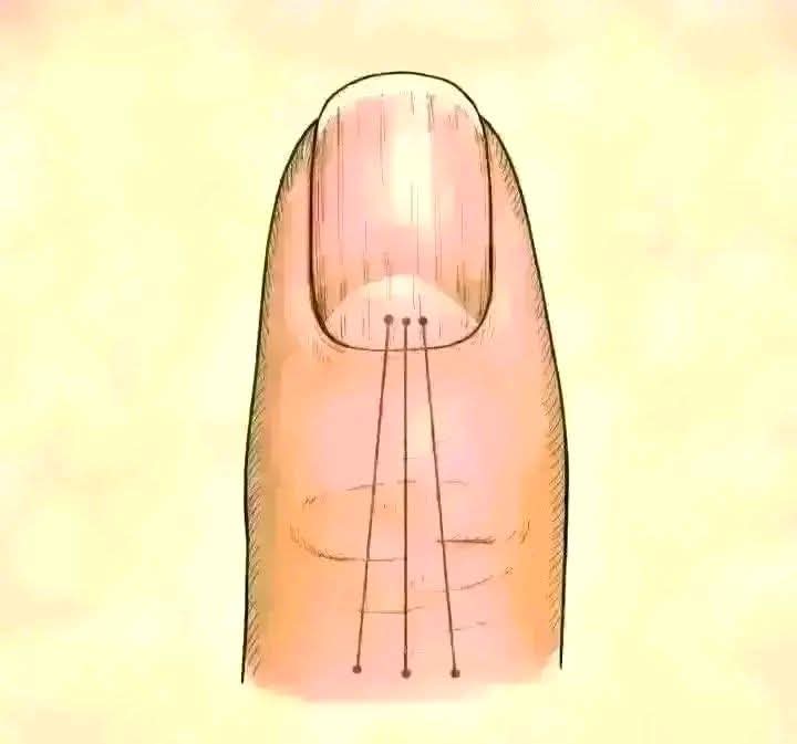 Si tienes rayas en tus uñas significa que tienes can…Ver mas