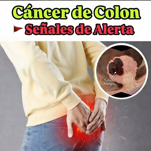Estas son las señales de CĀNCER de COLON que apare… Ver más