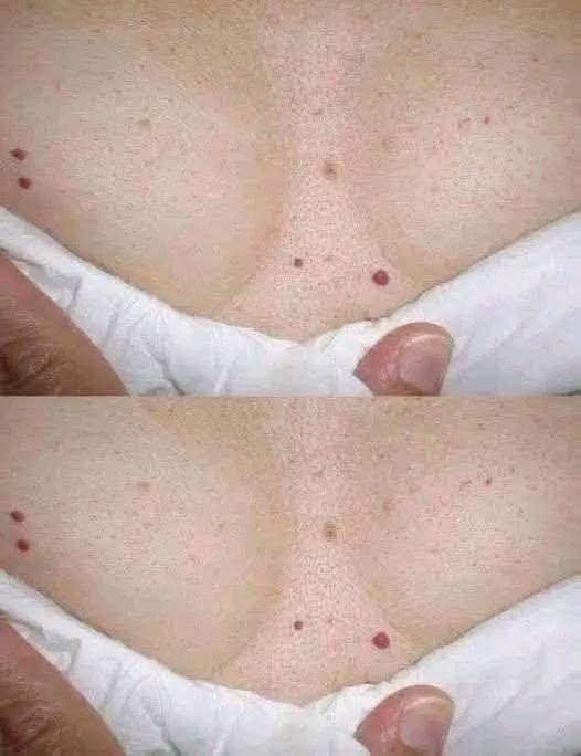 Si tienes puntos R0JOS, es una clara señal que tu cuerpo tiene c… á
