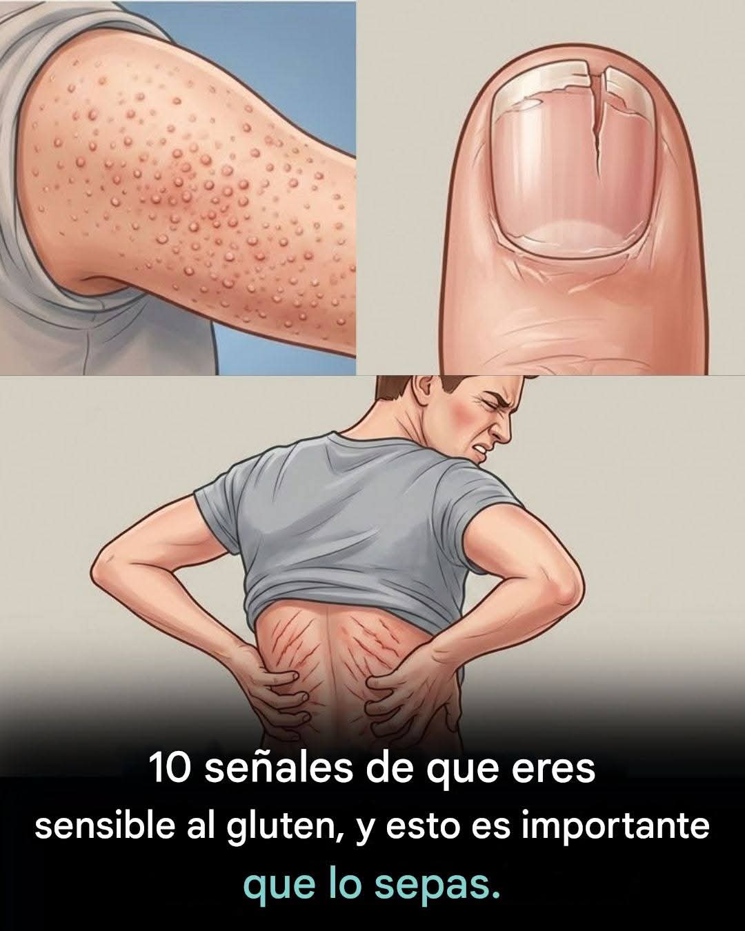 Señales de alerta: podrías ser sensible al gluten… y cuándo tomarlo en serio….Ver más
