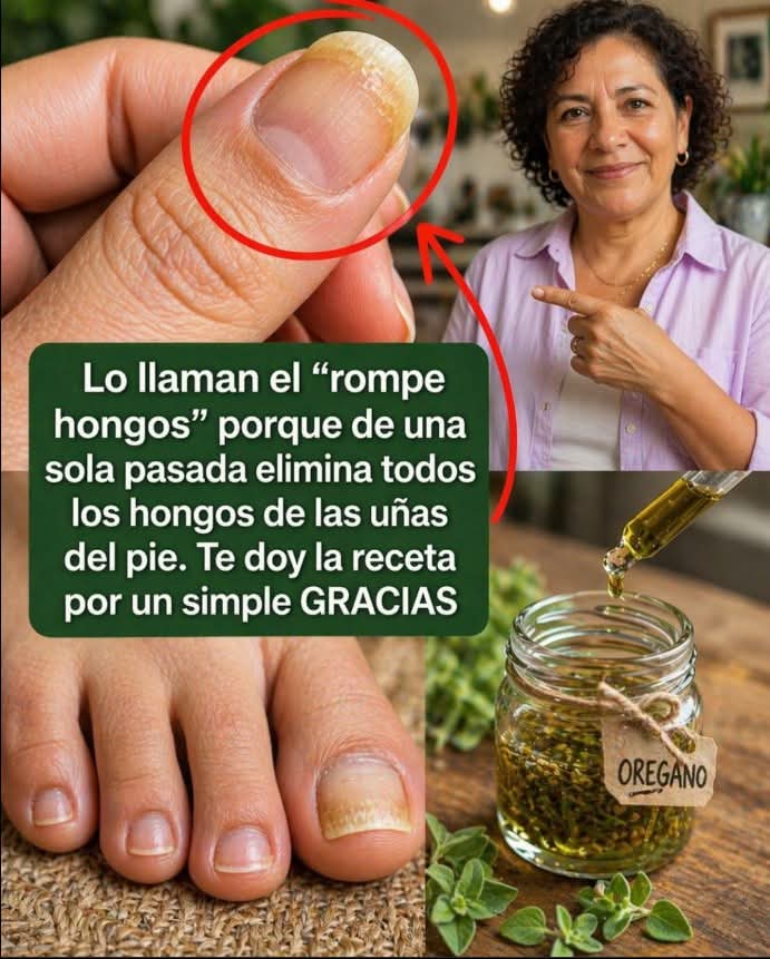 Lo llaman el “rompe hongos” porque de una sola pasa.. ver mas