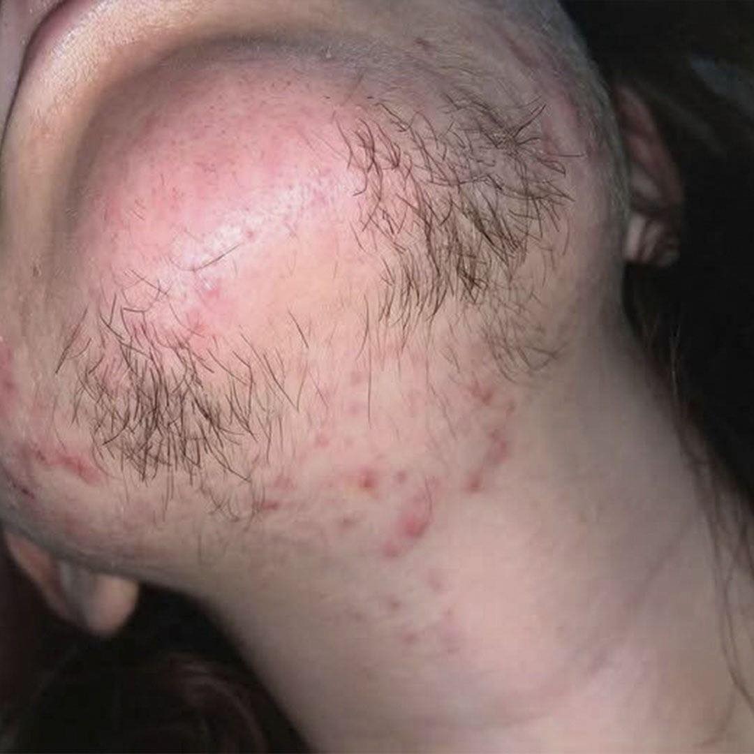 Si eres mujer y tienes pelo en la barbilla deberías saber c99…Ver más