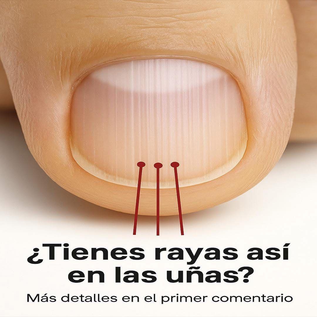 Si tienes estas rayas en tus uñas deberías conocer que tiene99…Ver más