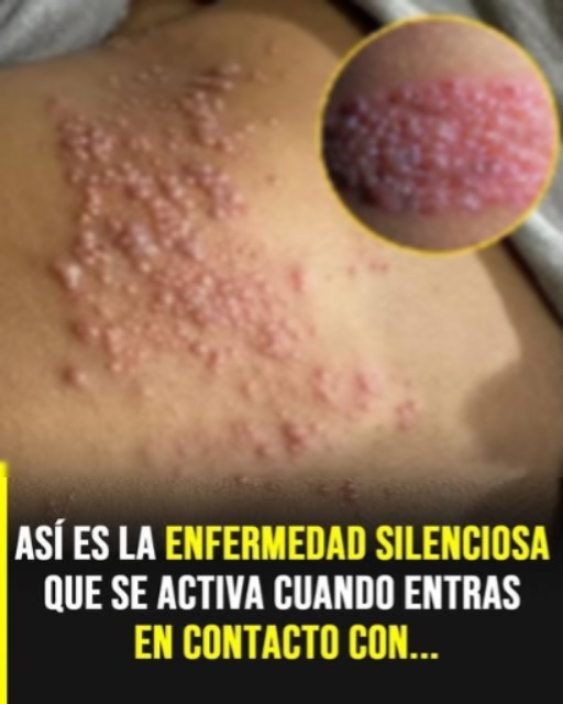 Así es la enfermedad que se activa cuando haces… Ver más