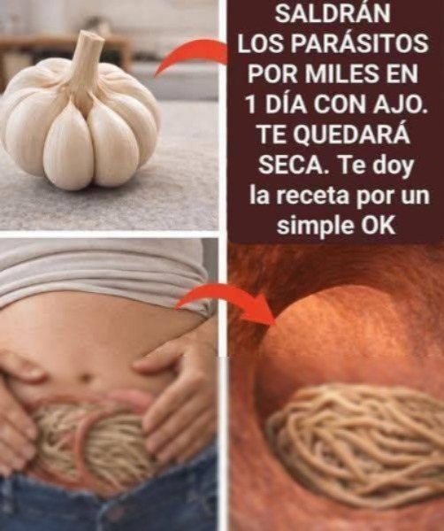 ¿El ajo elimina parásitos en solo 1 día? Lo que realmente debes saber antes de int… Ver más