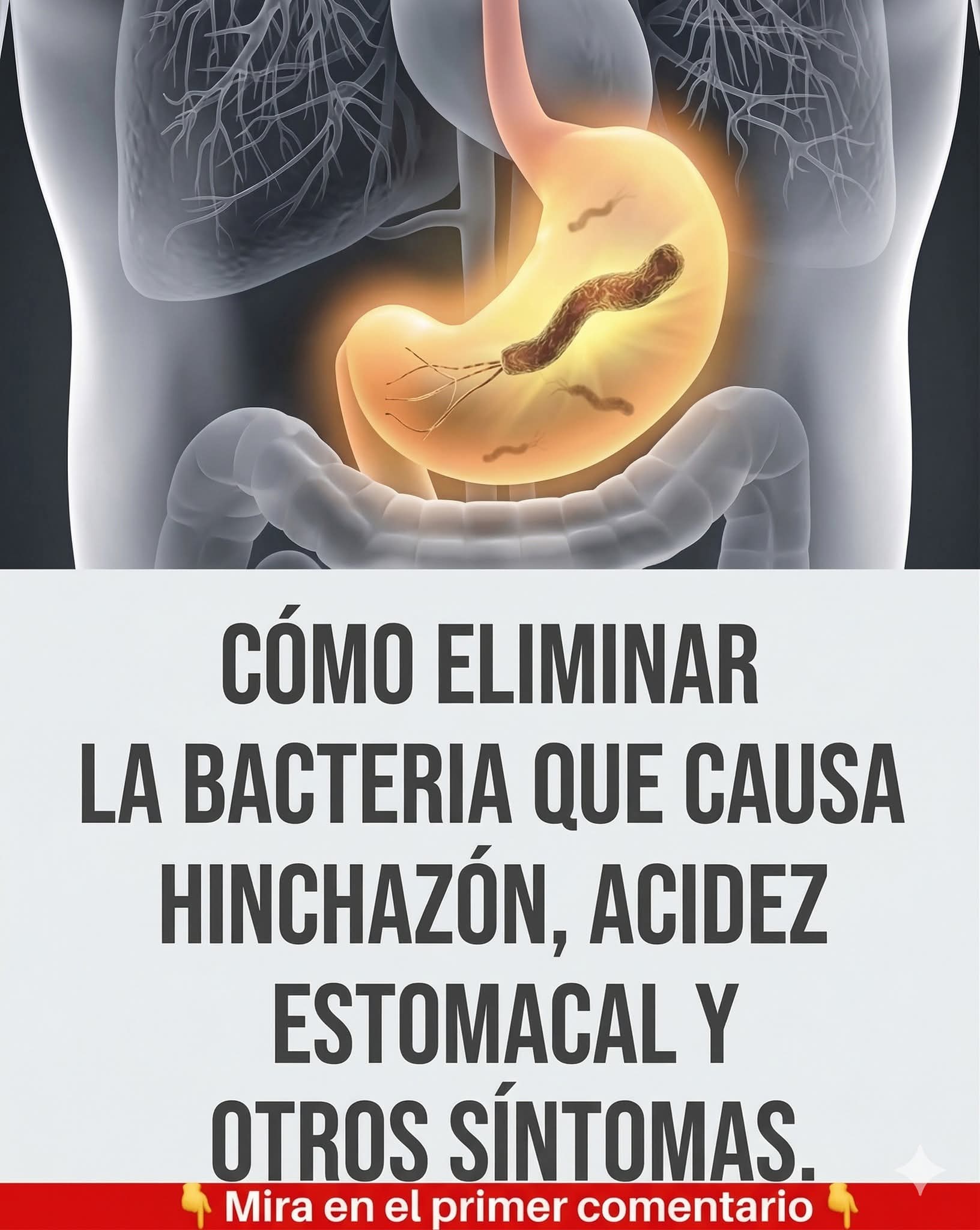 La bacteria que causa hinchazón… más