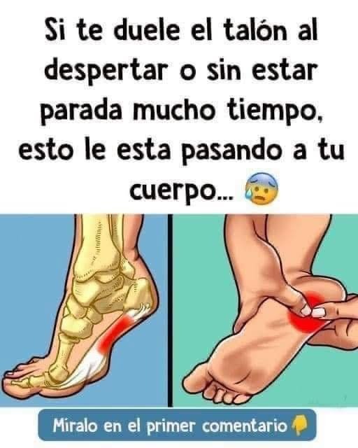 Si te duele el talón al despertar o sin estar parada mucho tiempo, esto le…vermas