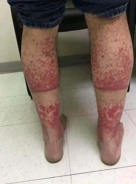 Estas son las consecuencias de dormir con… Ver más