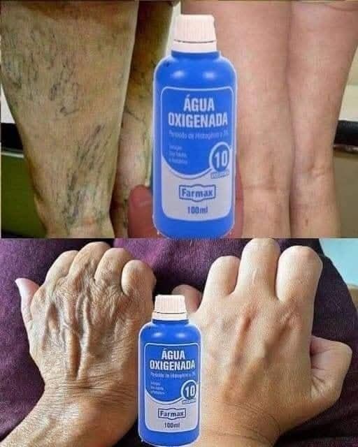 AGUA OXIGENADA ELIMIN4 ARRUG4S Y MANCHAS DEL ROSTRO, USALA DE ESTA MANERA… Ver más