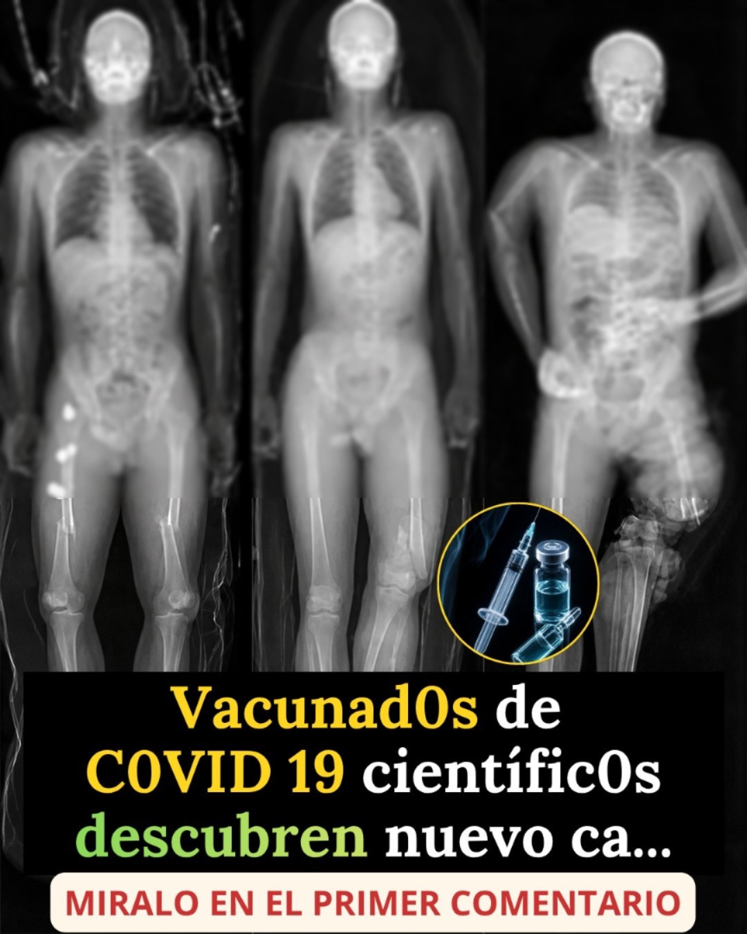 Si te pusiste la vacuna del COVID debes saber que puede provocar un ca… Ver más