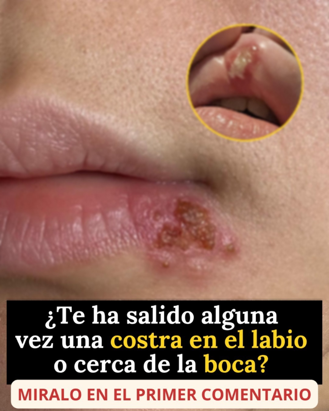 Estas se contagian cuando haces s..Ver Mas