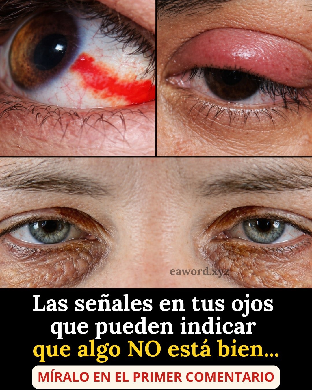 Señales en tus OJOS que indican… Ver más