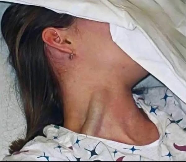 Estas son las consecuencias de dormir con un… Ver más