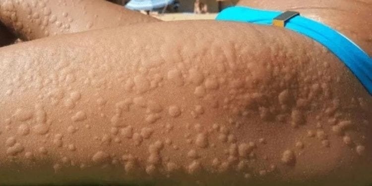Molleja de gallina de campo para dejar la bebida… Ver más