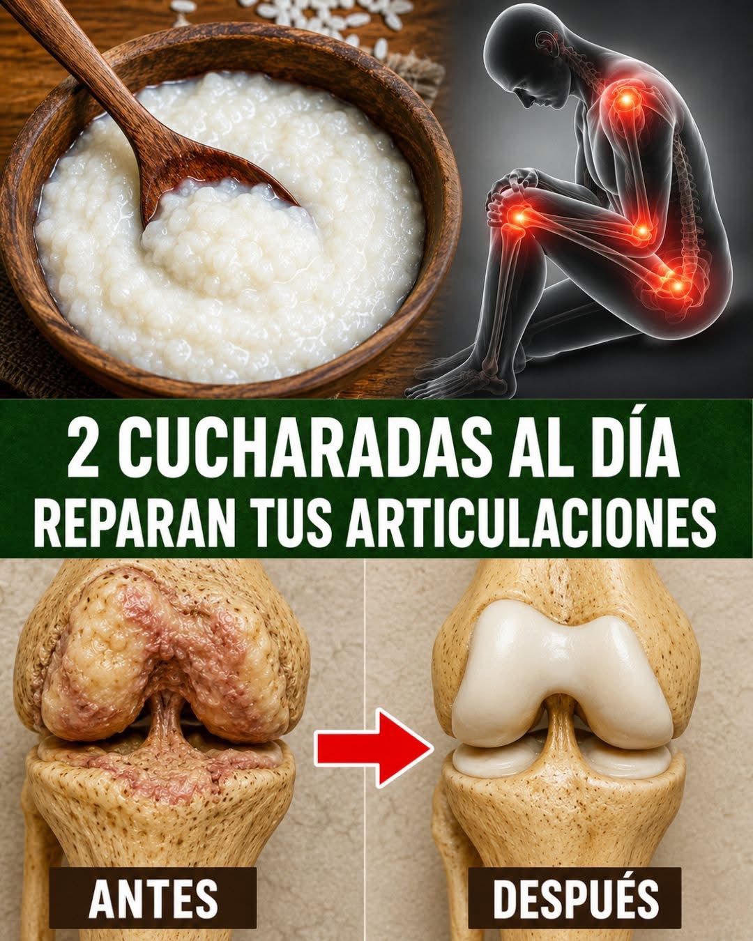 Un especialista en huesos y articulaciones de 97 años revela: ¡UN solo alimento reconstruye el cartílago de la rodilla en 24 horas! 👇 Preparación en el primer comentario.