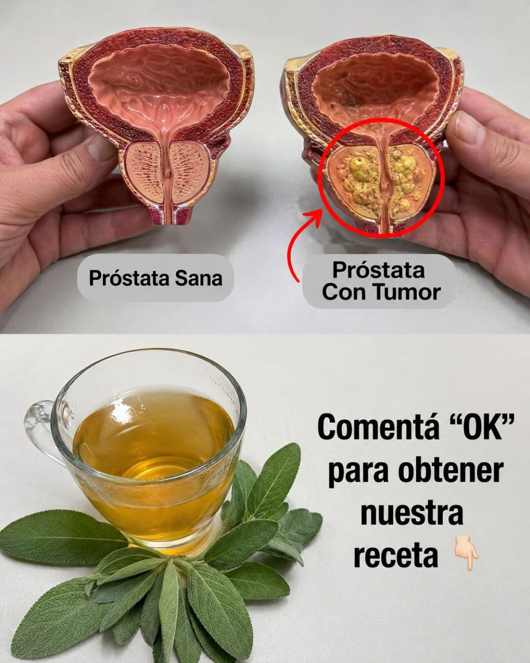 Ningún hombre debería morir de c4ncer de próstata: un poderoso remedio natural que todo hombre debería conocer.  Receta completa en el primer comentario 👌