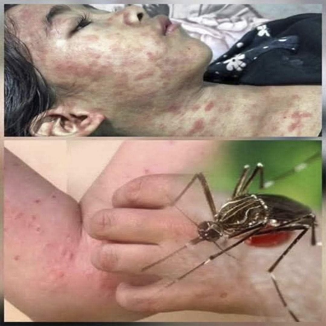Cuidado estas son las consecuencias de dormir con…Ver más