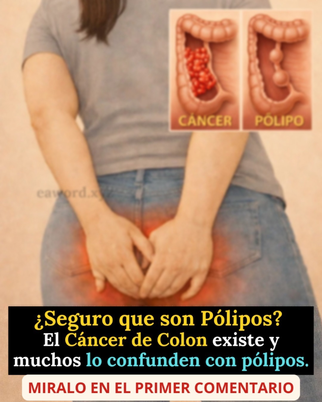 El cáncer de colon: las señales silenciosas que muchos ignoran… Ver más
