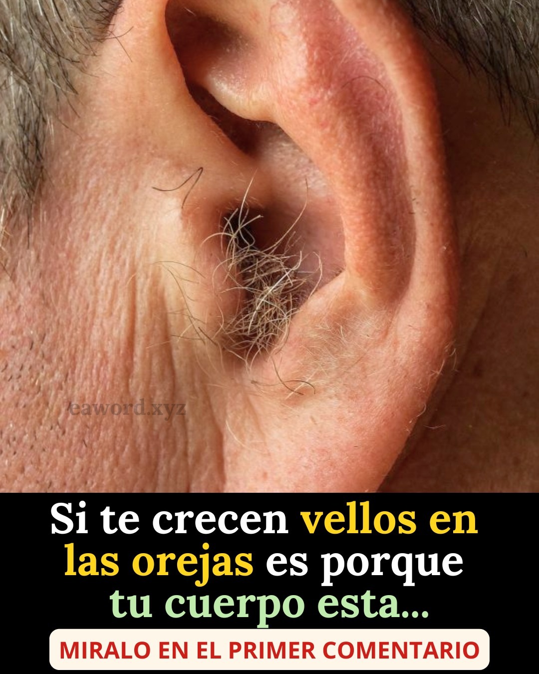 Si te crecen vellos en las orejas, es porque tu cuerpo está… Ver más