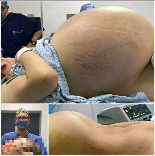 Fue al Hospital a Dar a Luz y No Vas a Creer lo Que Sacaron de su vie…Ver más