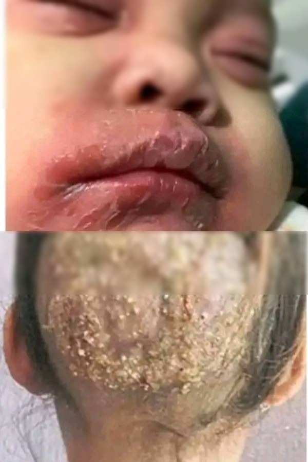 Estás son las c0nsecuencias de acostarse con1…Ver más